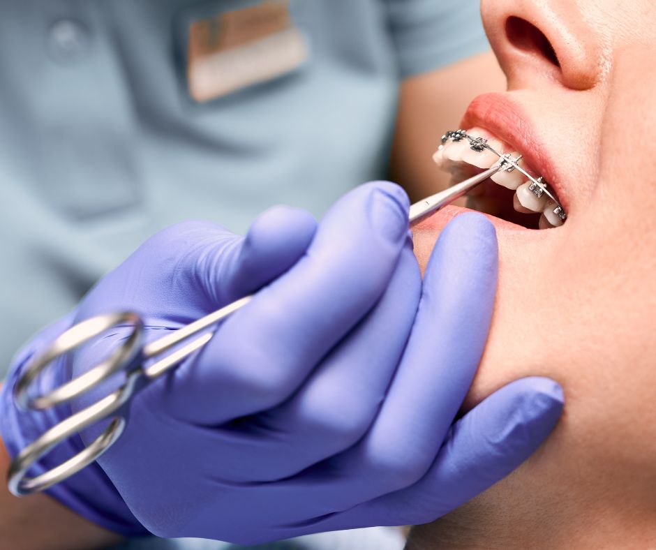 The Most Common Orthodontic Emergencies Cascadia Smiles Orthodontics